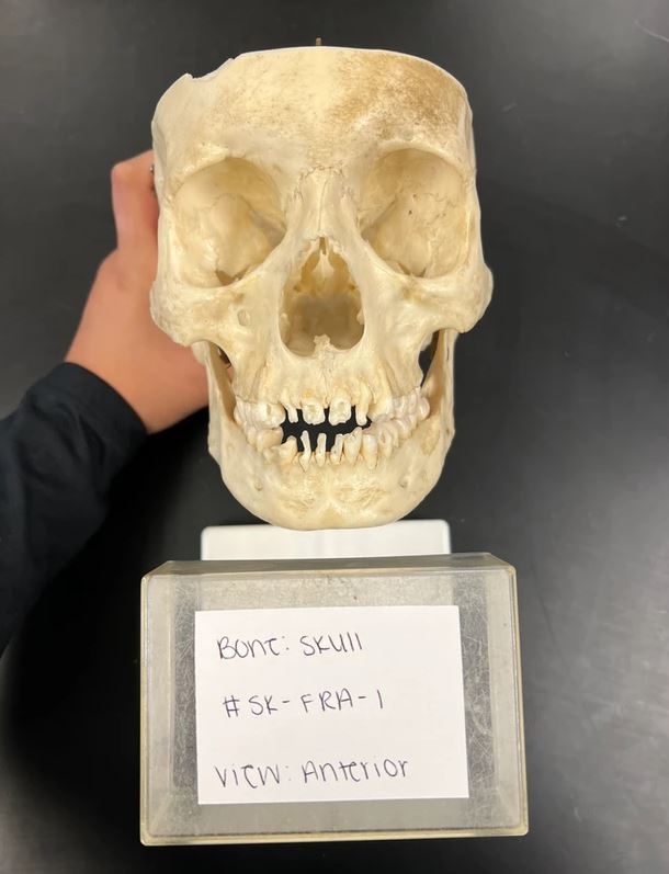 Skull